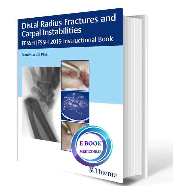 دانلود کتاب Distal Radius Fractures and Carpal Instabilities: FESSH IFSSH 2019 Instructional Book 2021 (ORIGINAL PDF)